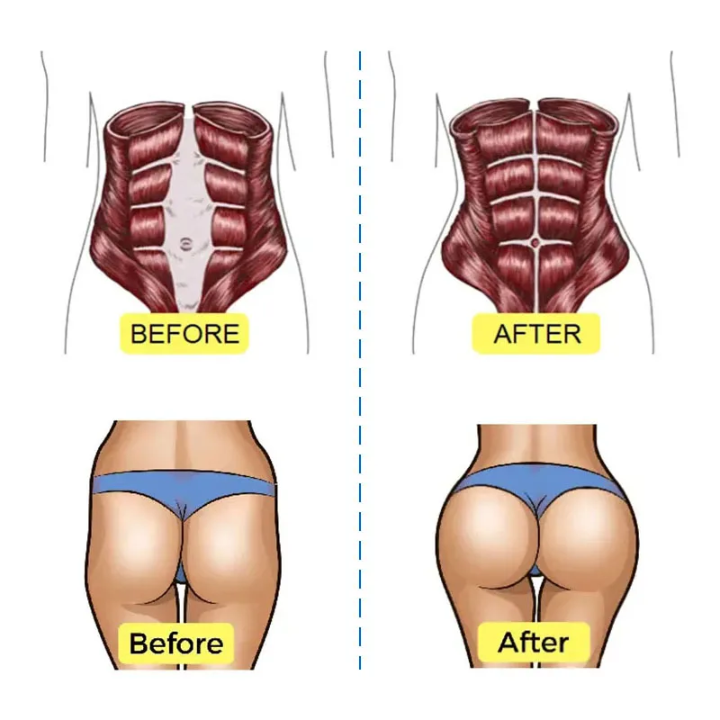 Illustrative before-and-after style body-contouring graphic